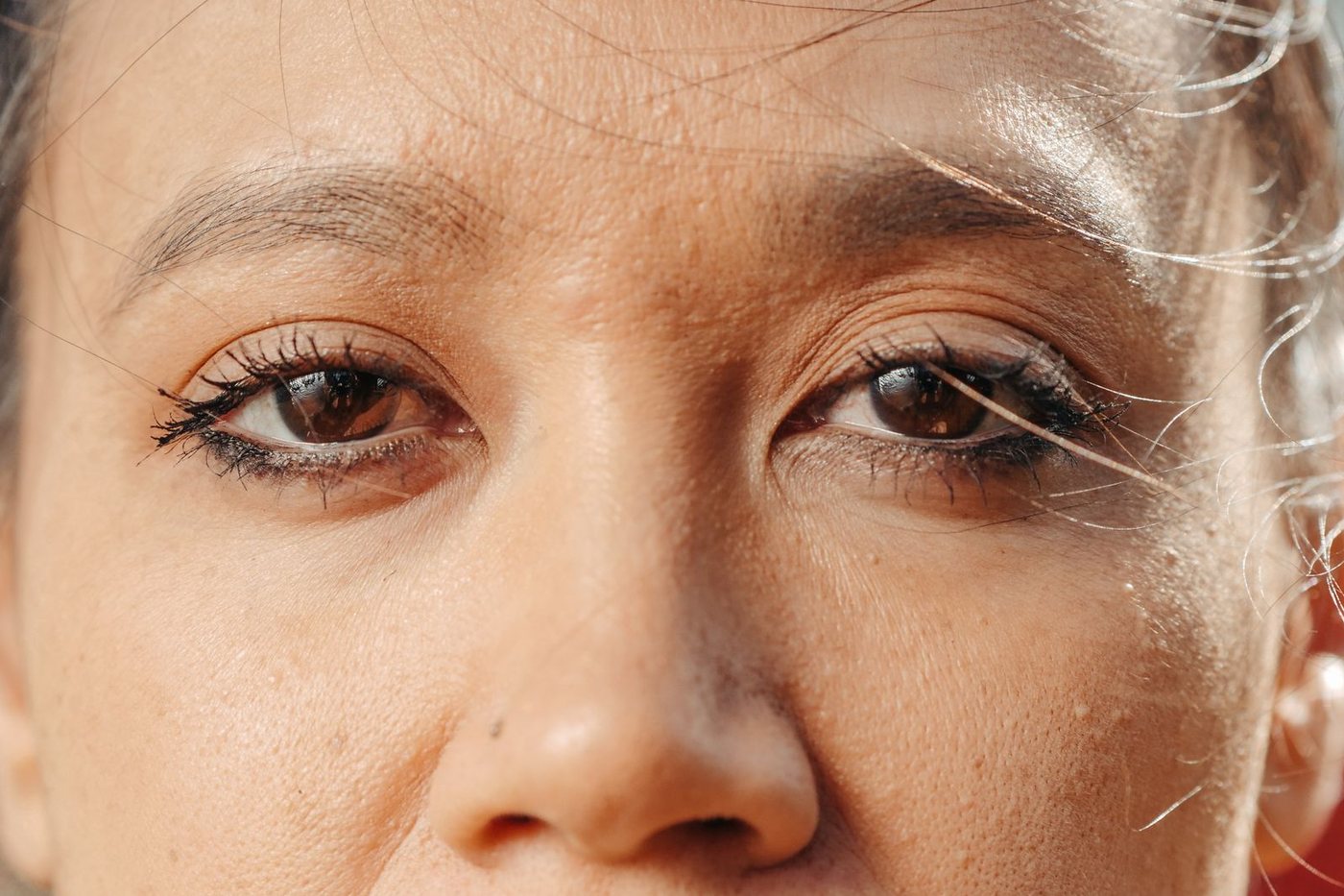 Blefaroplastia (Cirurgia das Pálpebras)